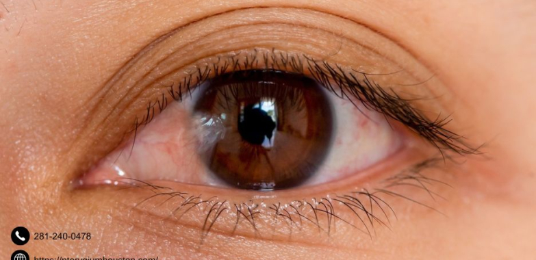Eye Surgery Pterygium Removal | Pterygiumhouston.com