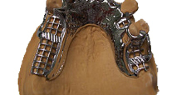 Restore Your Smile: Trusted Denture Fixes in Australia