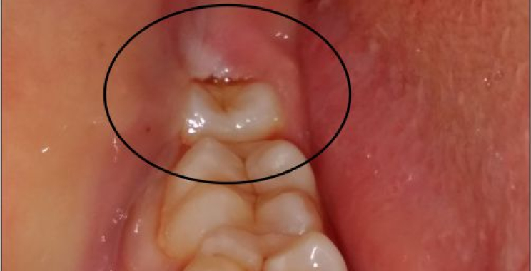 Cosmetic Dentistry in Rajkot: Brighten Your Smile Today