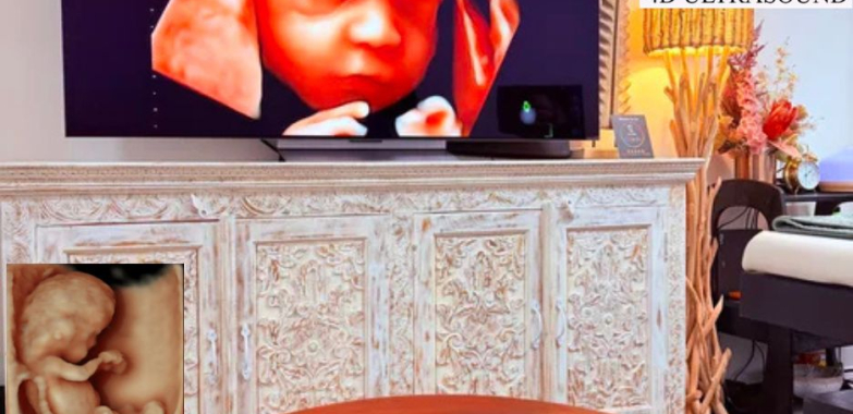 Pregnancy 3D/4D Scans in Perth | Gentle, Bonding Imaging