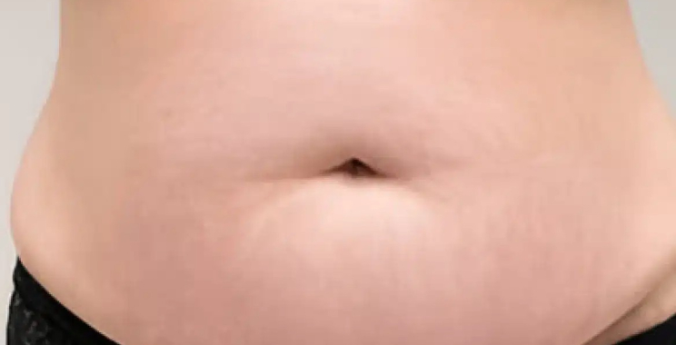 Restore even skin tone with expert vitiligo care in Dubai