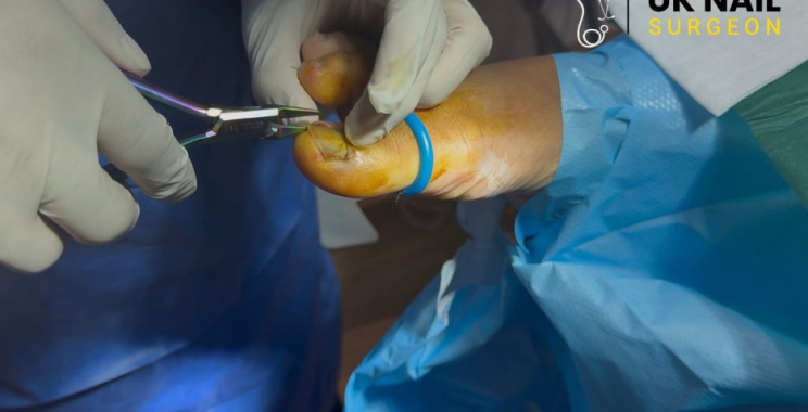 Expert Nail Procedures for Quick Pain Relief and Recovery