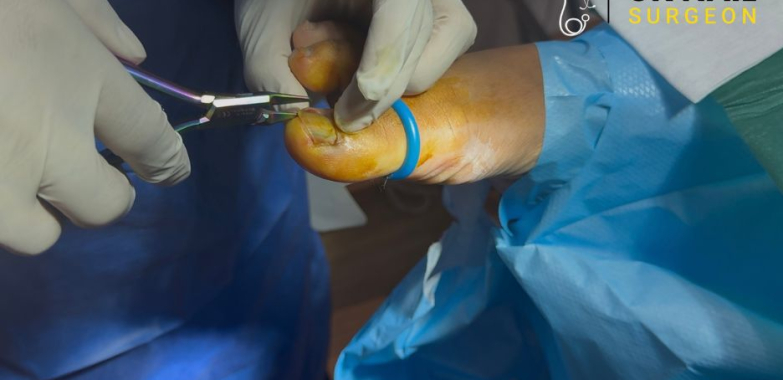 Expert Nail Procedures for Quick Pain Relief and Recovery